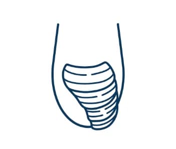 爪が厚くなっている（肥厚爪など）